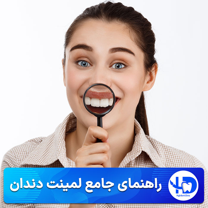 راهنمای جامع لمینت دندان