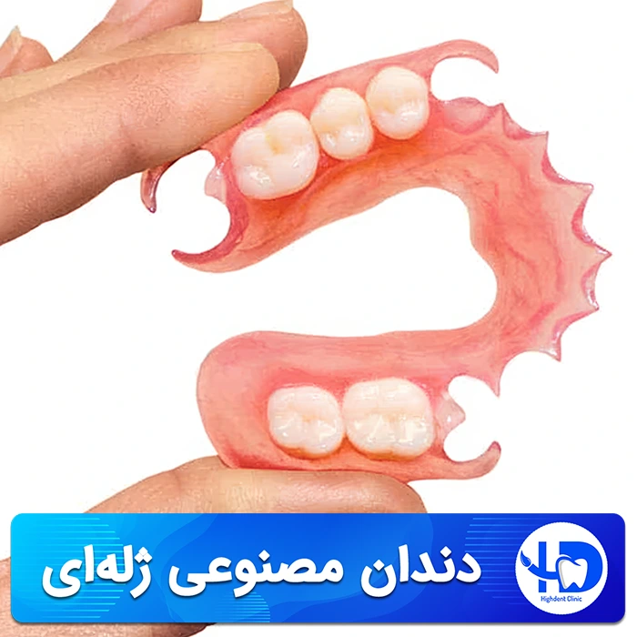 راهنمای کامل دندان مصنوعی ژله‌ای