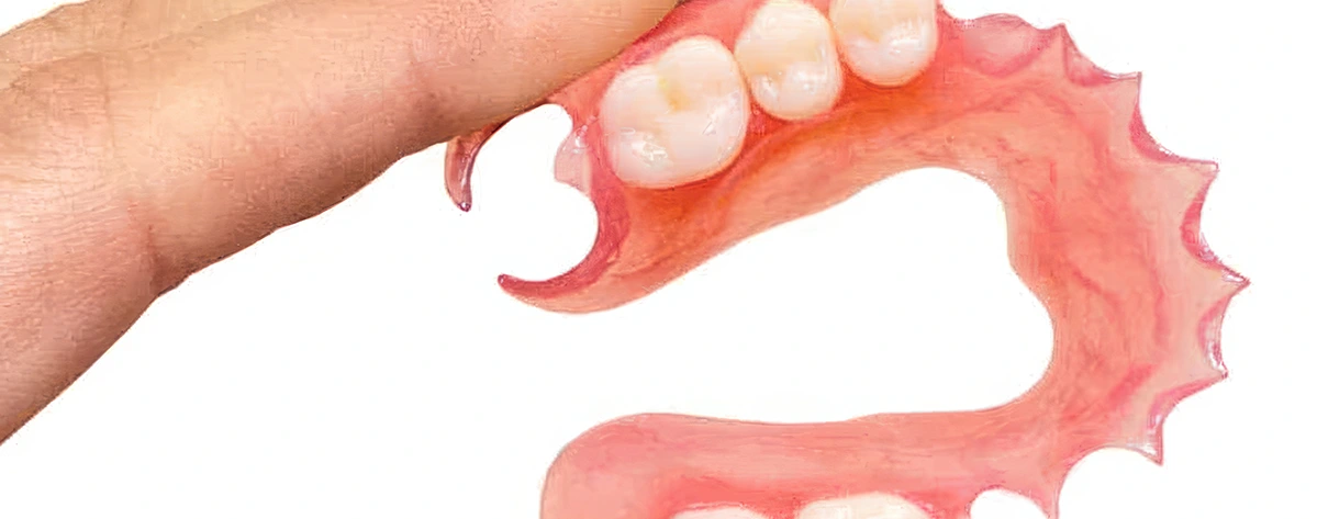 دندان مصنوعی ژله‌ای، نحوه ساخت