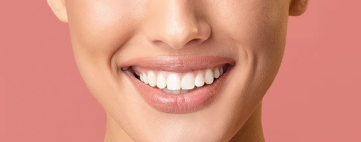 دندان های مناسب برای لمینت