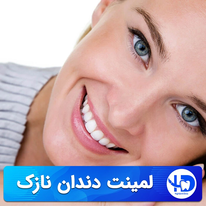 لمینت دندان نازک و مرور مزایا و معایب