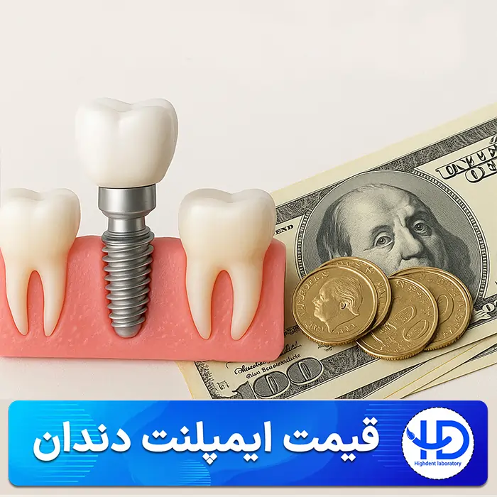 قیمت ایمپلنت دندان